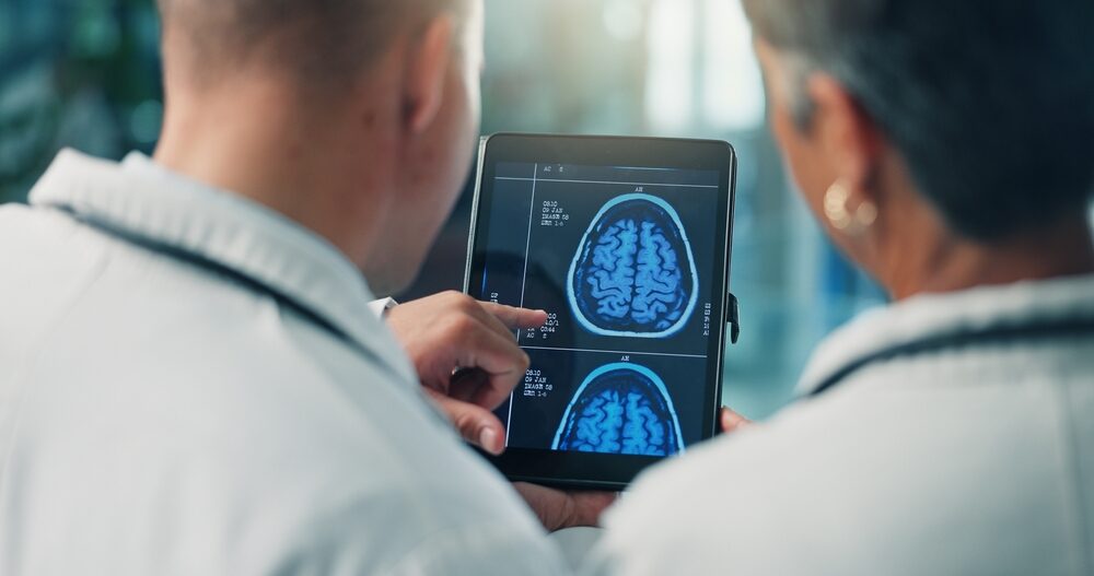 Fibrillazione atriale e rischio cognitivo